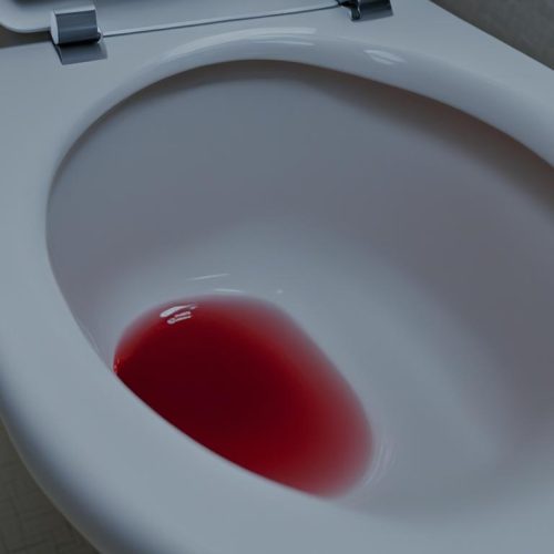 large amount of bright red blood in toilet no pain
